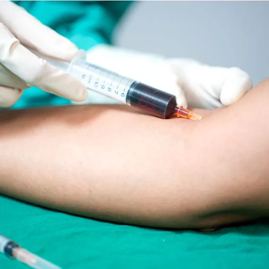 Culture Anaerobic Blood Test